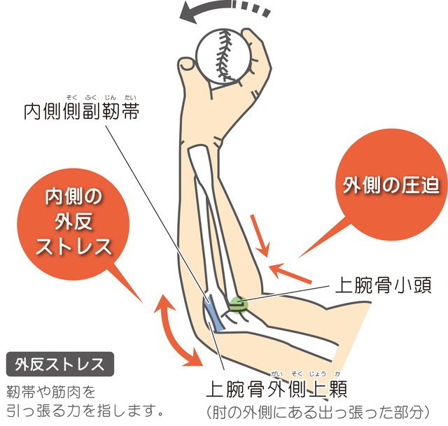 肘 の 内側 が 痛い 野球