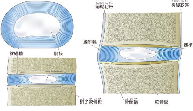 椎間板　繊維輪　髄核　前縦靭帯　後縦靭帯　線維輪　髄核　梢子軟骨板　骨端輪　軟骨板