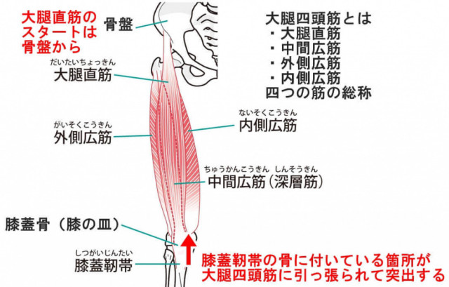 大腿四頭筋　大腿直筋　内側広筋　中間広筋　外側広筋