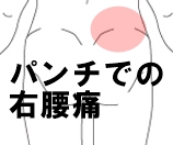 パンチでの右腰痛