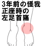 3年前の怪我　正座時の左足首痛