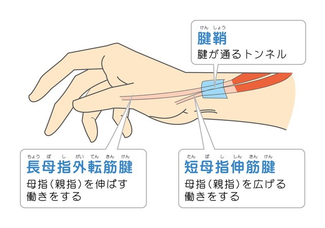 腱鞘　腱が通るトンネル　長母指外転筋腱　母指親指を伸ばす働き　短母指伸筋腱　母指親指を広げる働き