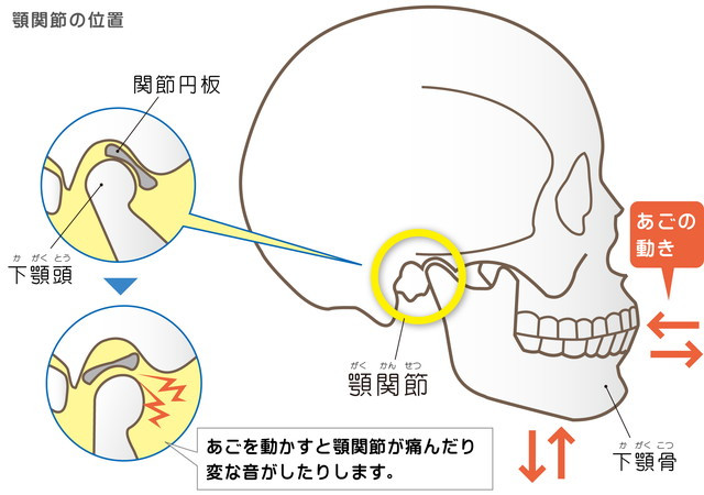 顎関節症　関節円板　下顎骨　