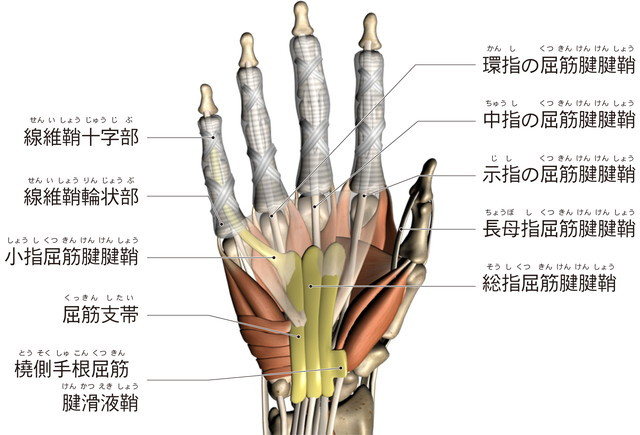ばね指　屈筋腱症