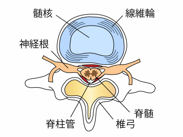 椎間板　髄核　線維輪