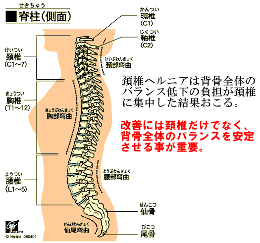 頚椎ヘルニア　頚椎　胸椎　腰椎　頚部湾曲　胸部湾曲　腰部湾曲
