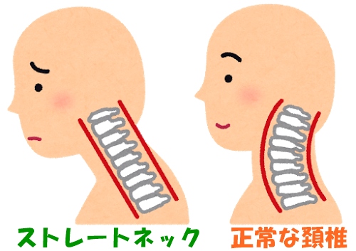 ストレートネック　正常な頚椎