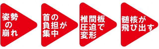 姿勢の崩れ　首の負担が集中　椎間板圧迫　髄核が