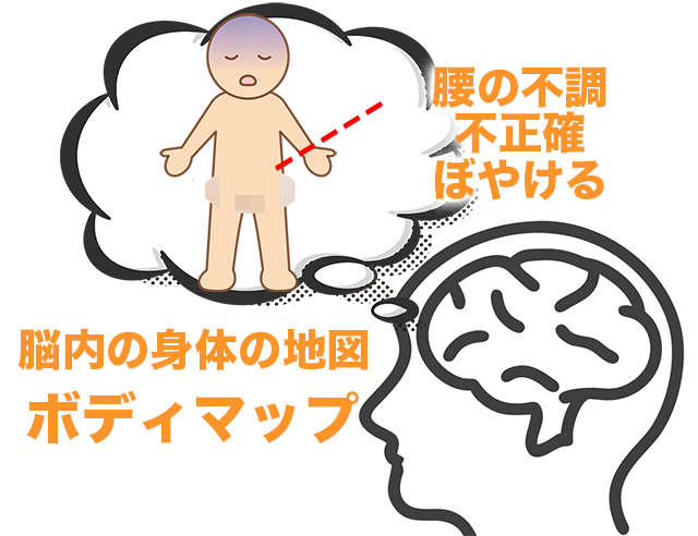 ボディマップ