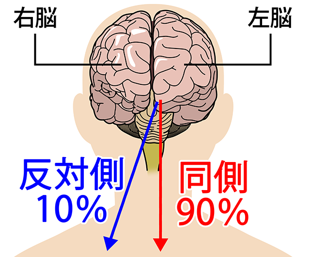 脳　同側90％