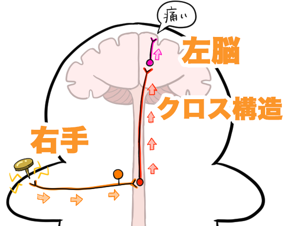 脳　クロス構造