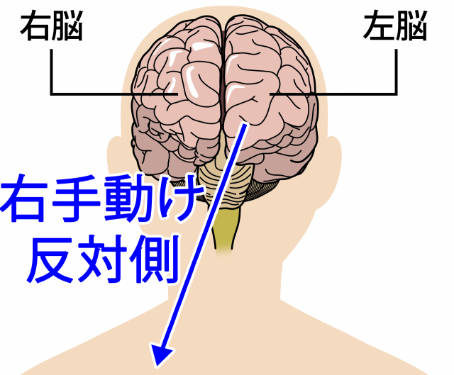 下行性疼痛抑制系